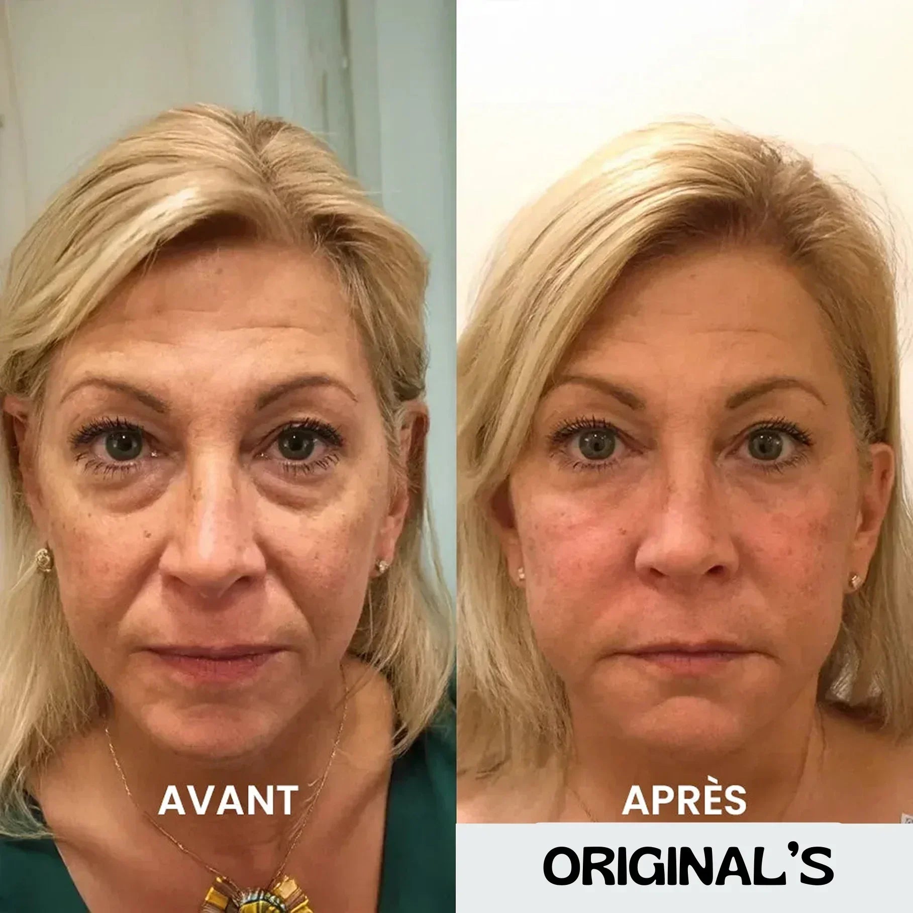 Crème anti-cernes et rides instantanée