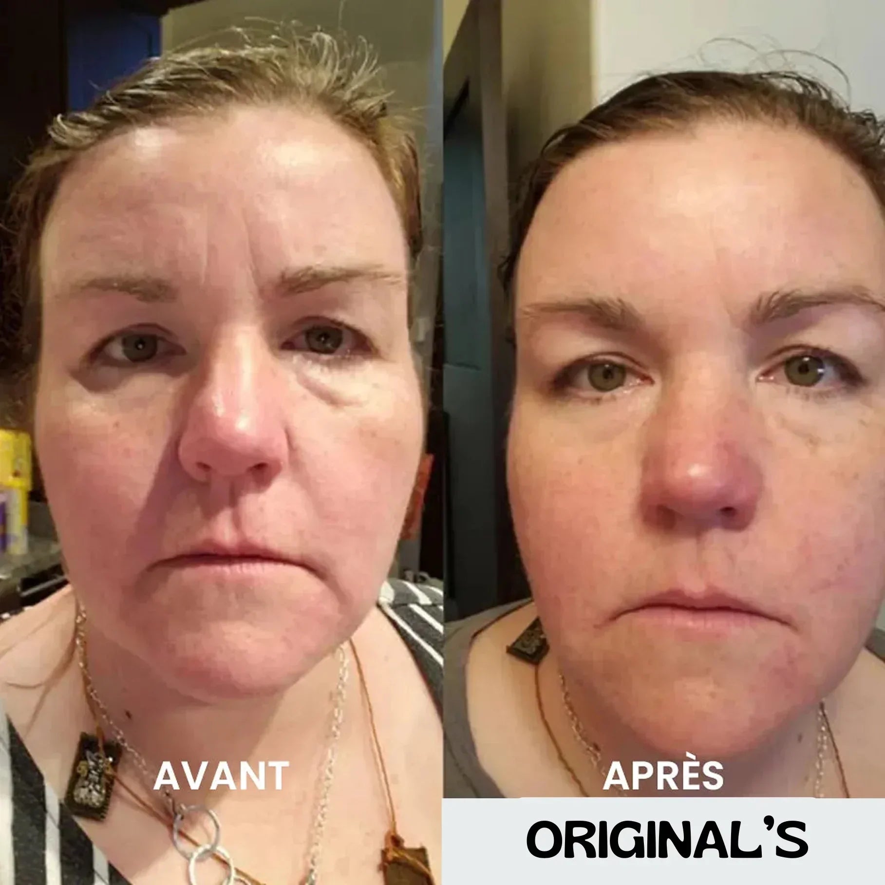 Crème anti-cernes et rides instantanée