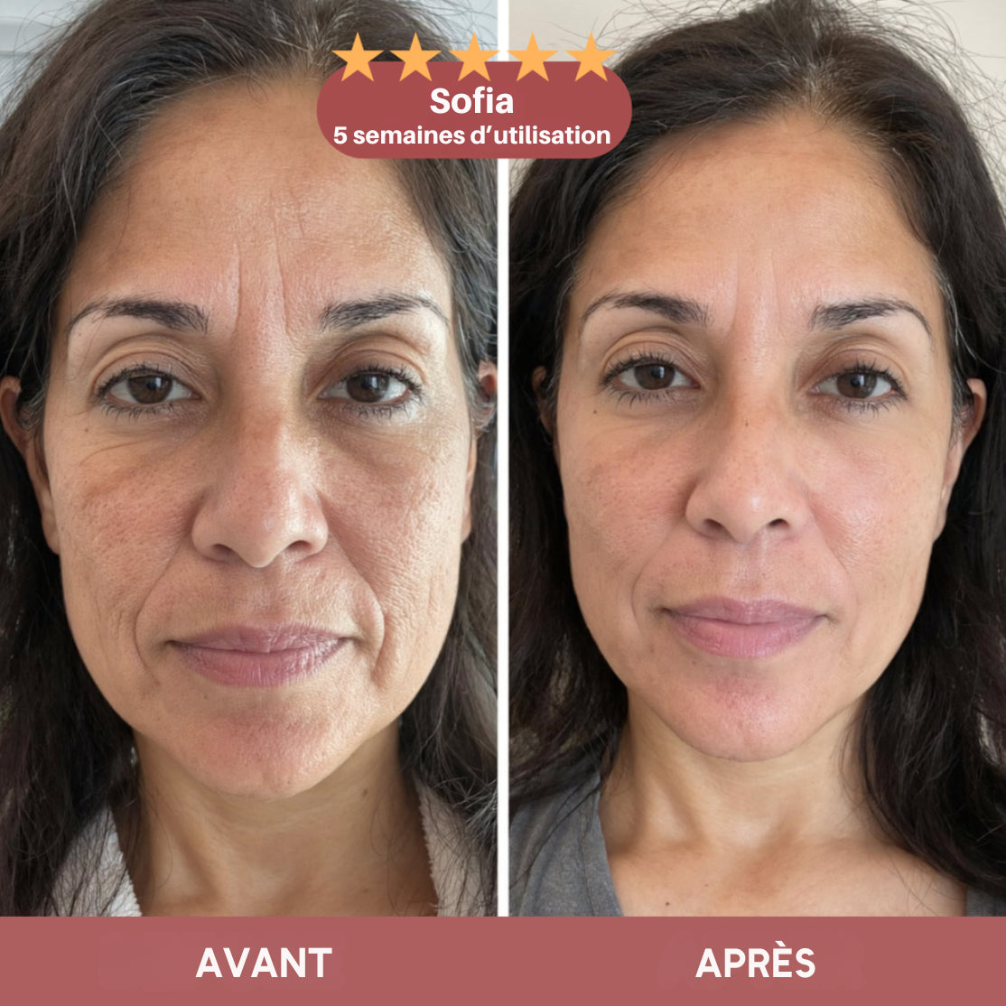 Baume repulpant anti-rides au calcium