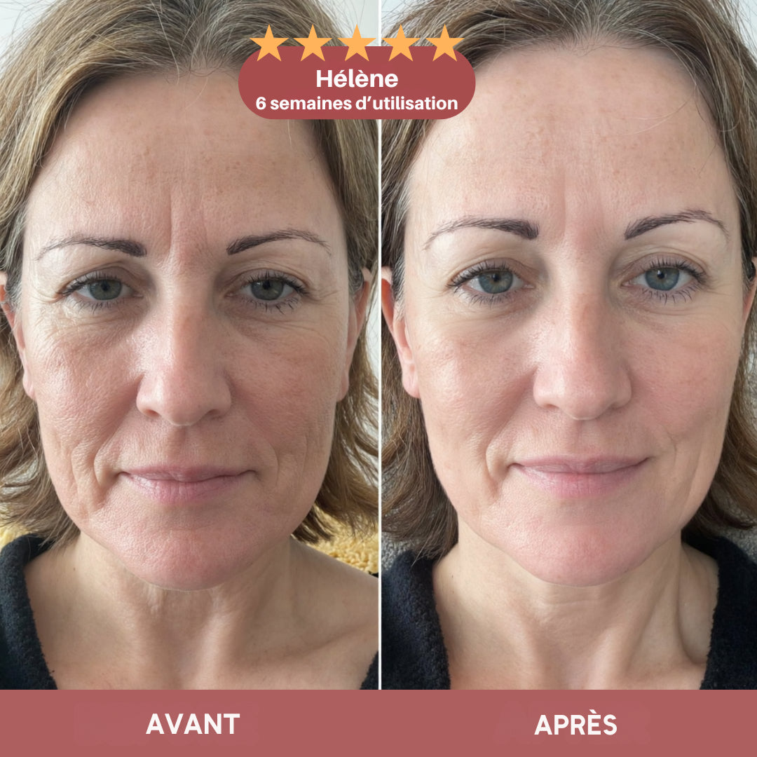 Baume repulpant anti-rides au calcium