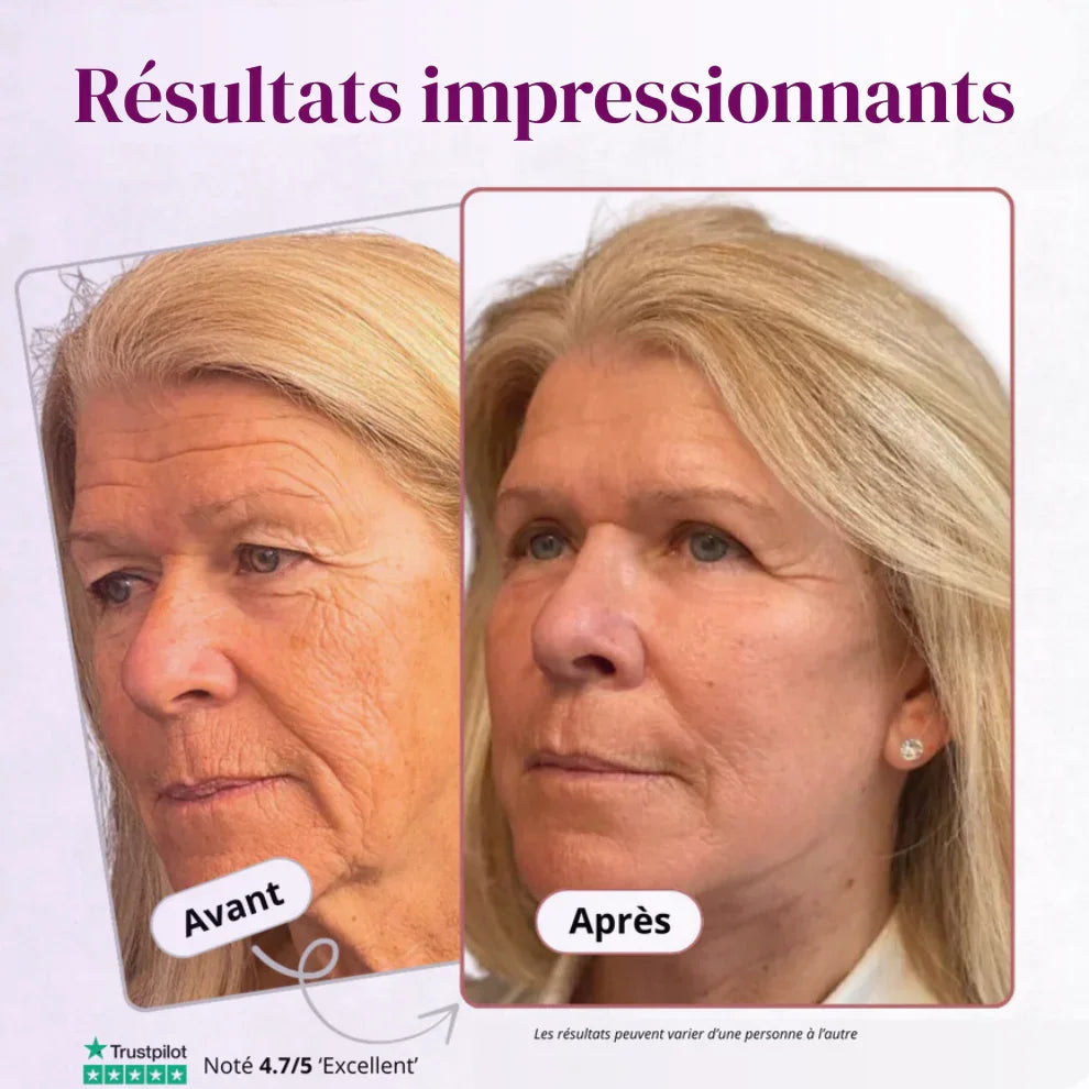 Baume repulpant et anti-rides au calcium