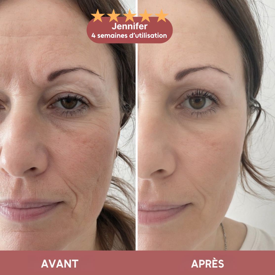 Baume repulpant anti-rides au calcium