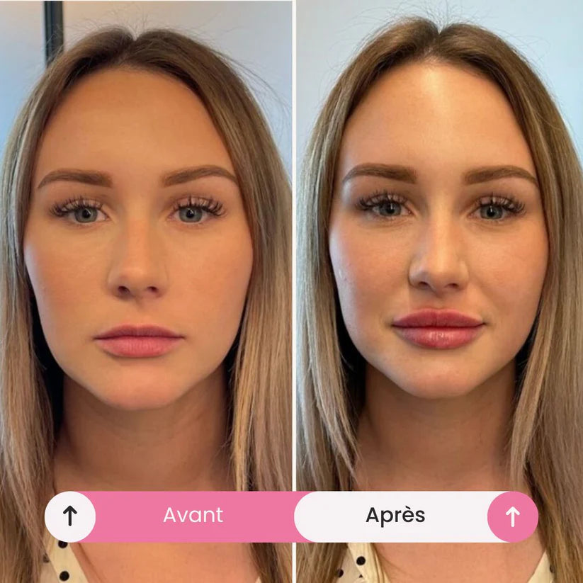 Gloss volume instantané