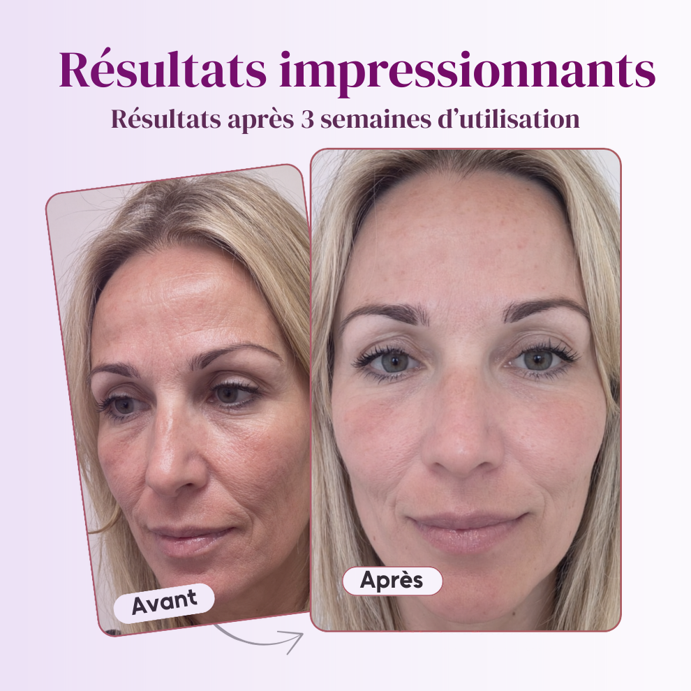 Baume repulpant anti-rides au calcium