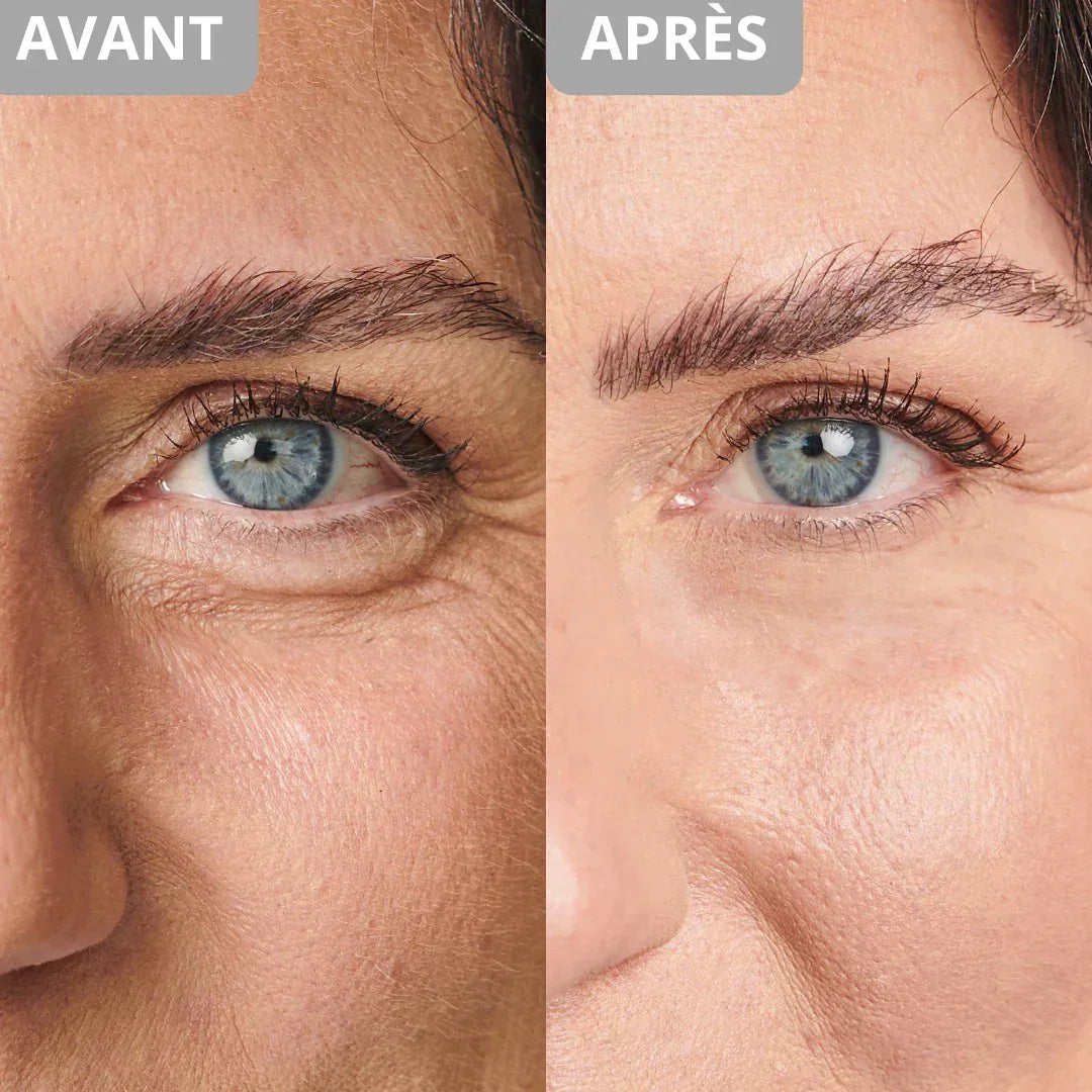 Crème anti-cernes et rides instantanée