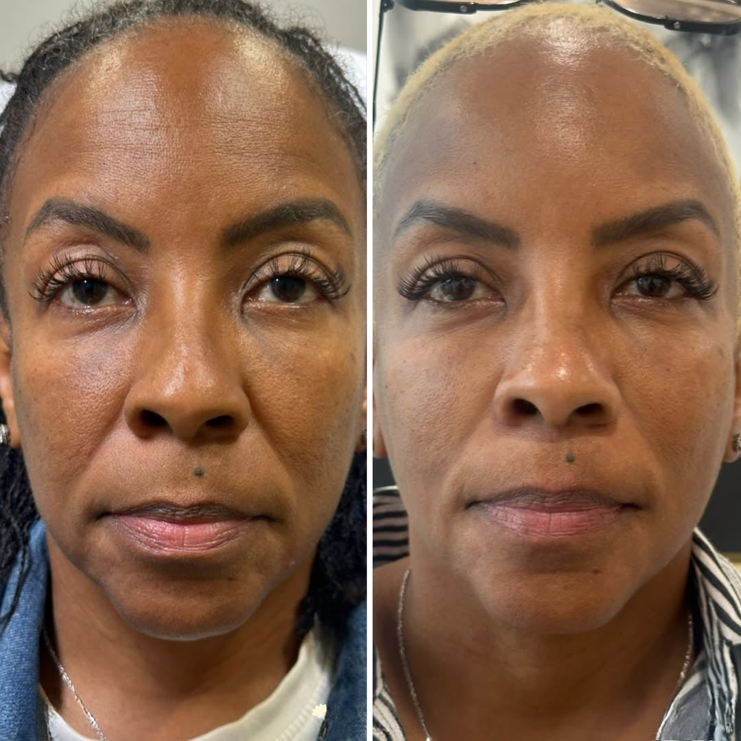 Masque intense au bio-collagène