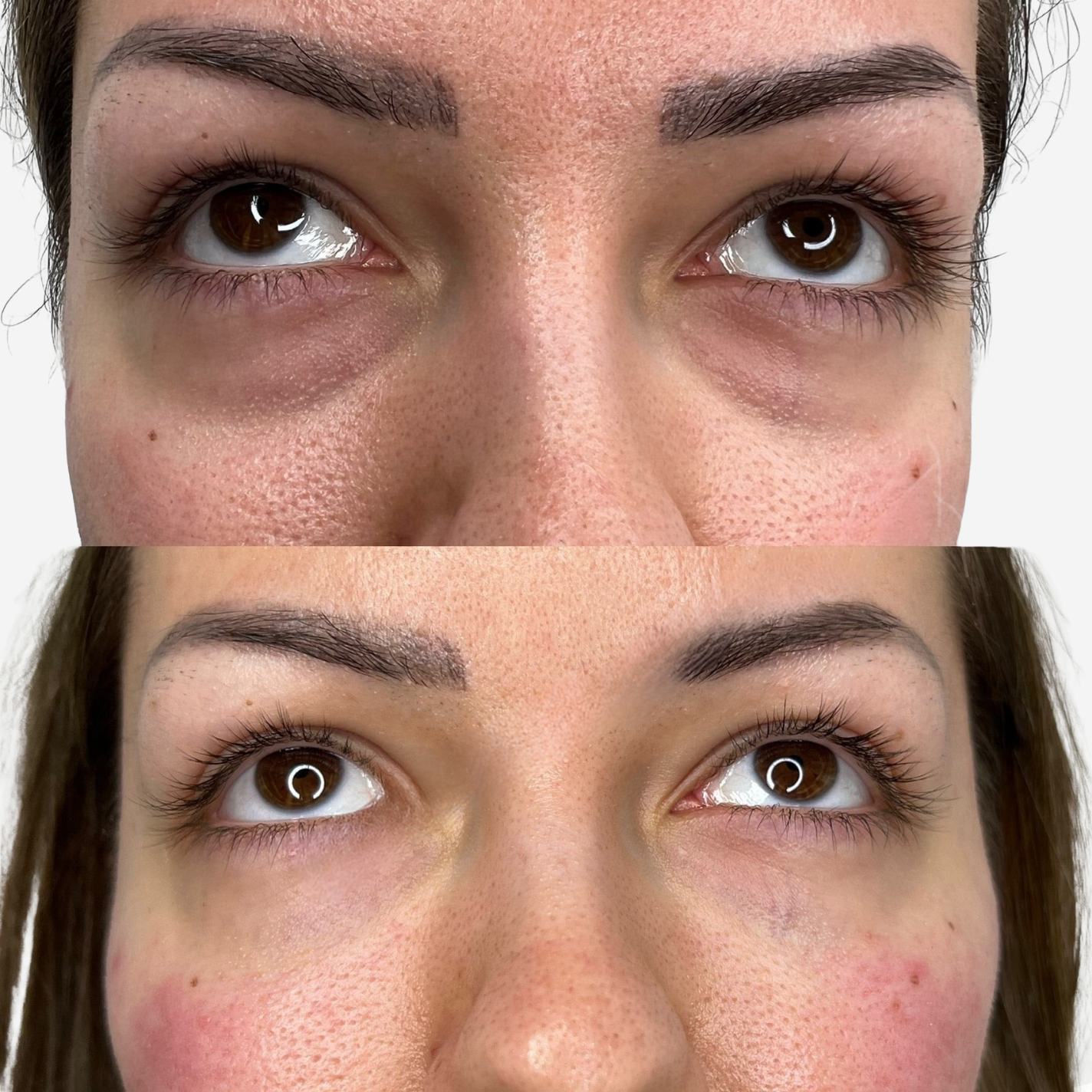 Patchs lissants aloe vera et collagène