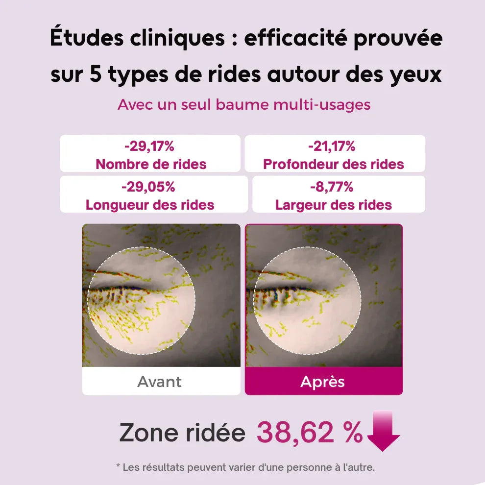 Baume repulpant et anti-rides au calcium
