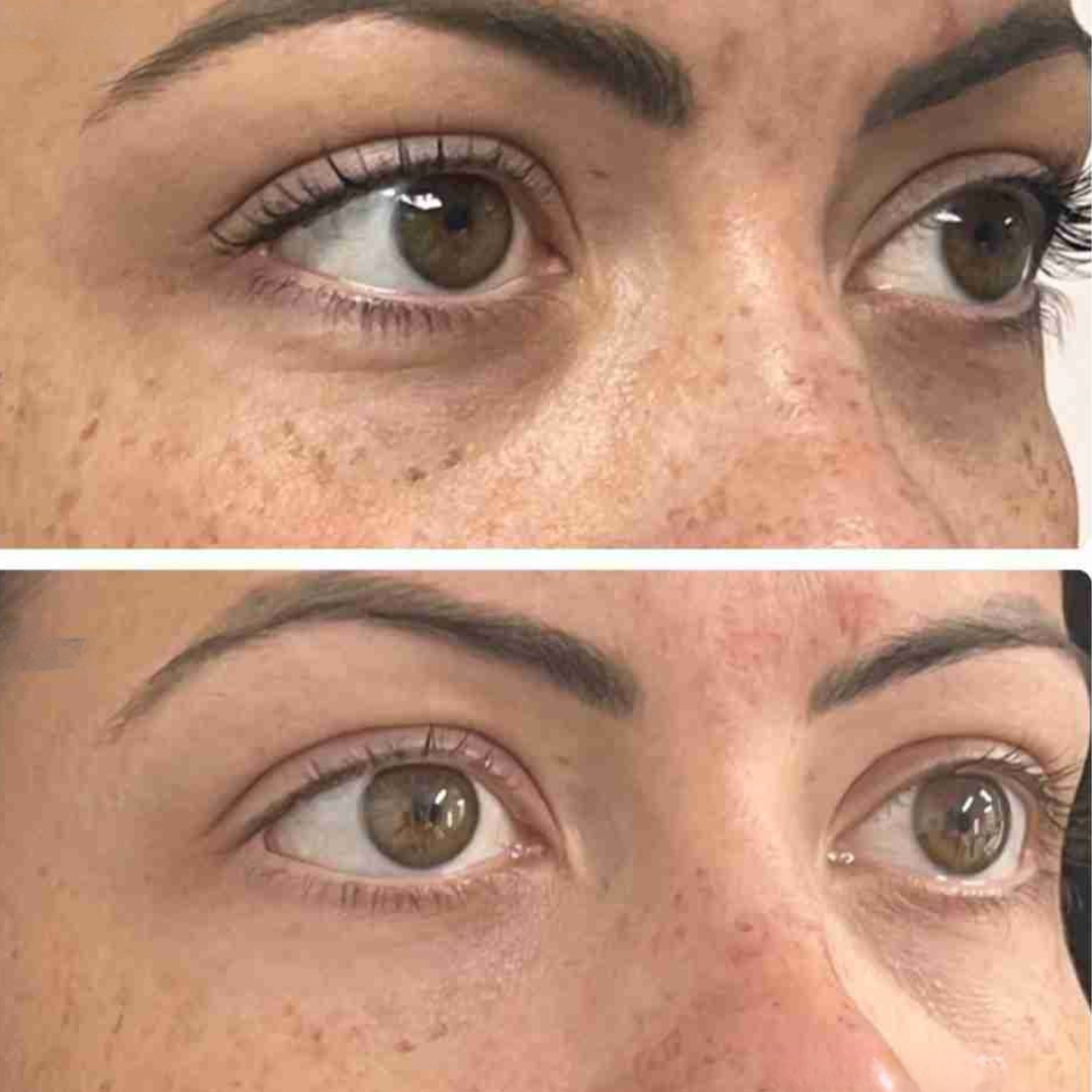 Patchs lissants aloe vera et collagène