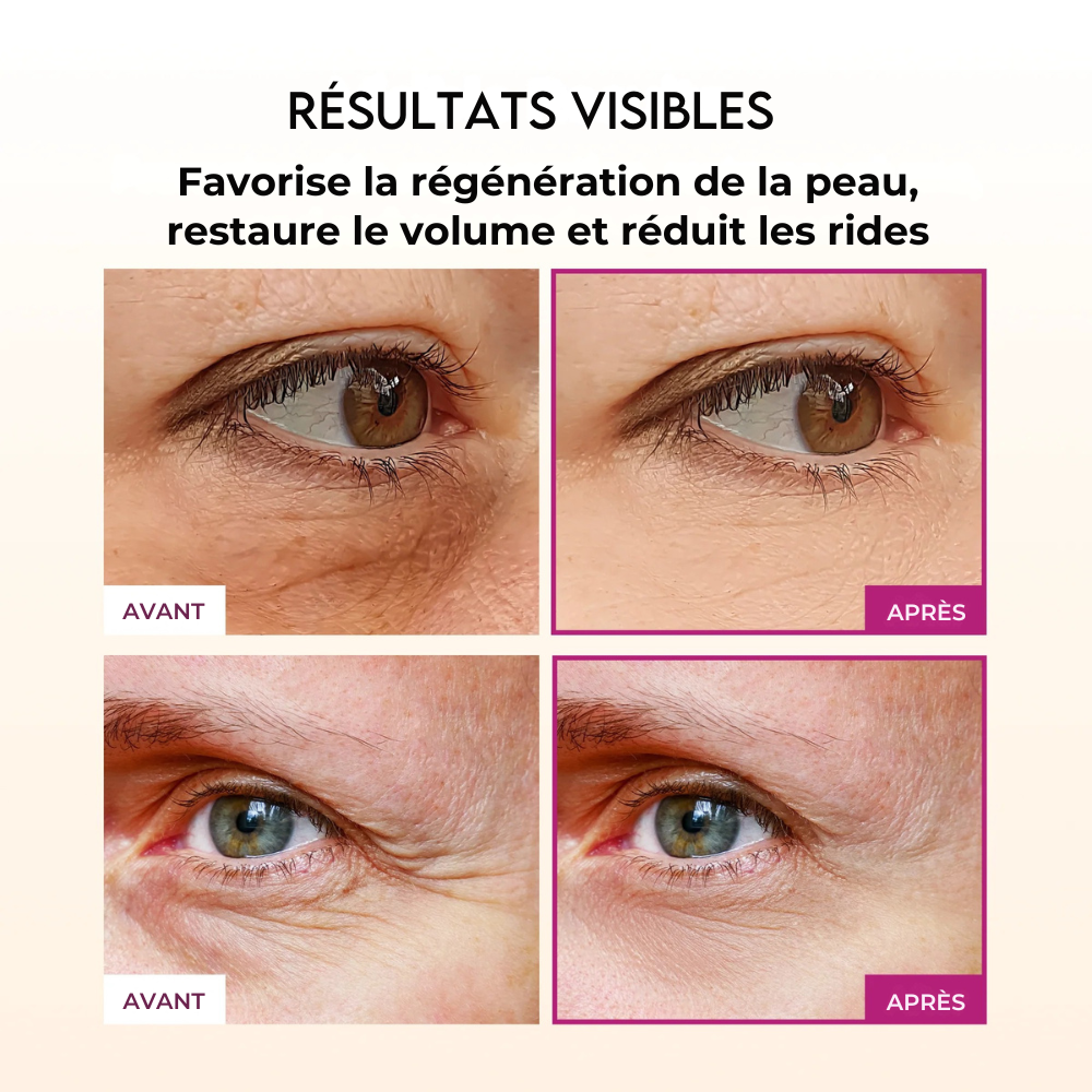 Baume repulpant anti-rides au calcium